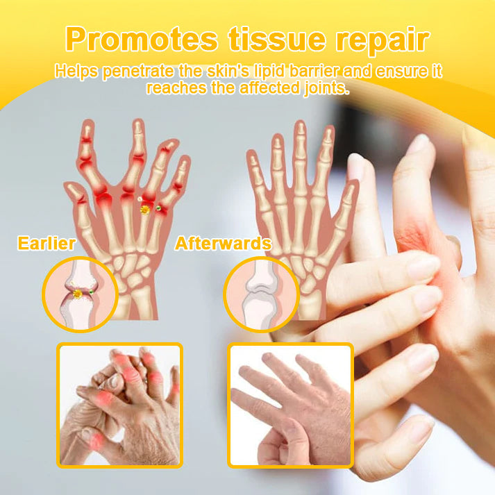 TLOPA® Botulinum Toxin & Bee Venom Pain-Relief Bone Healing Cream💎