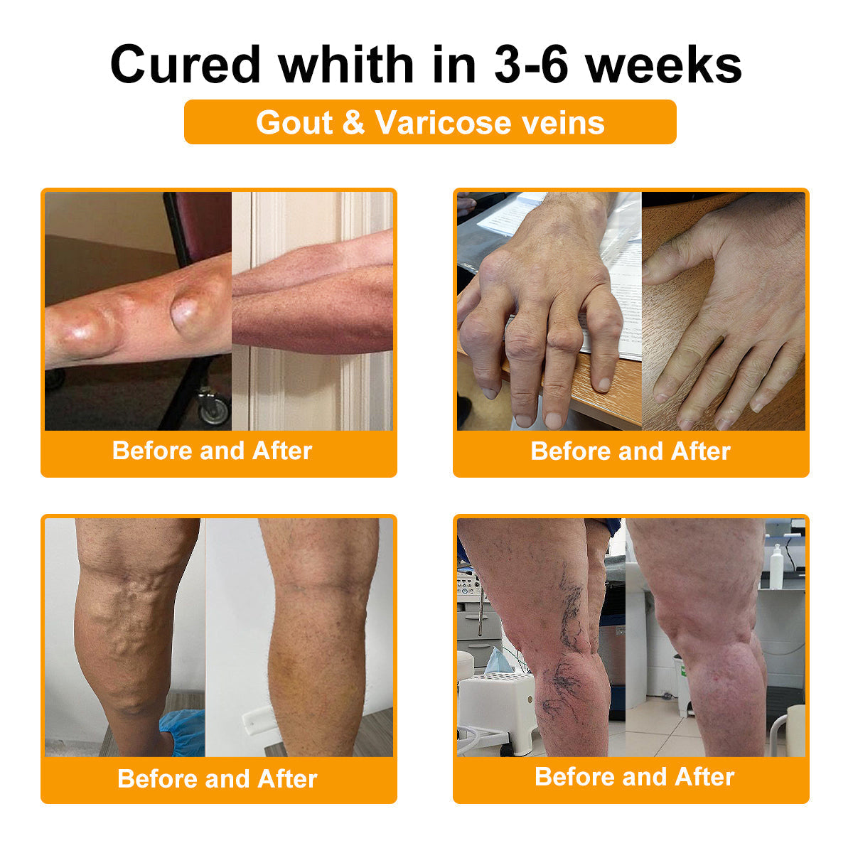 TLOPA® Botulinum Toxin & Bee Venom Pain-Relief Bone Healing Cream💎