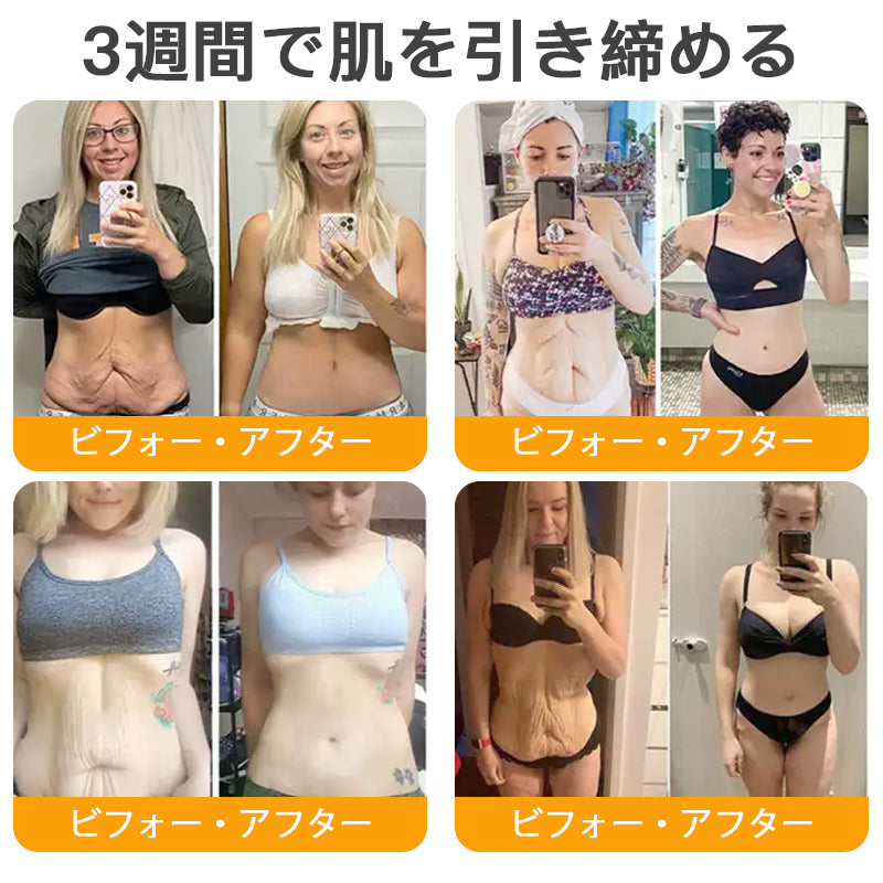 【代金引換可】🌿 TLOPA® 蜂毒スキンリペアクリーム 🔥【最終日】本日限定 80%オフ!🎁