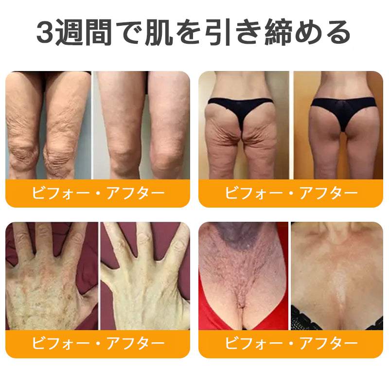 【代金引換可】🌿 TLOPA® 蜂毒スキンリペアクリーム 🔥【最終日】本日限定 80%オフ!🎁