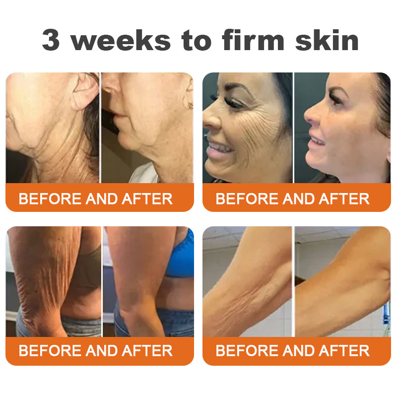 Made and Shipped from UK✨🌿TLOPA® Botox Bee Venom Firming Serum Stick(🔥LAST DAY 70% OFF)🌟