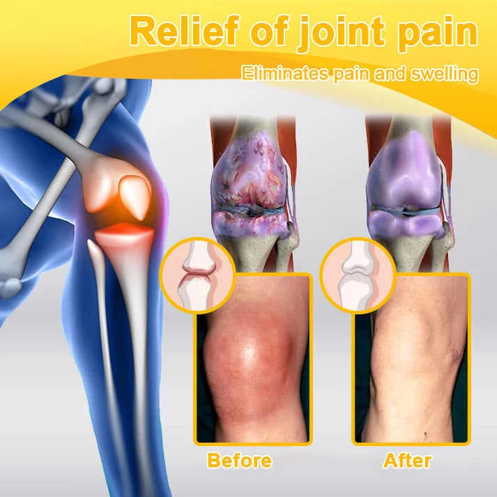 TLOPA® Botulinum Toxin & Bee Venom Pain-Relief Bone Healing Cream💎