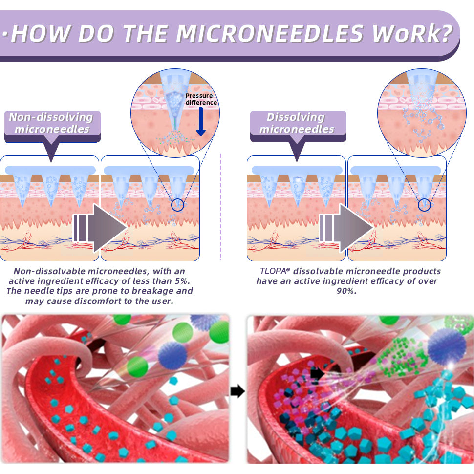 TLOPA® SMGT-GLP-1 Nano Microneedle Patch: A Painless, Long-Lasting Solution for Diabetes, Obesity, and Cardiovascular Ailments