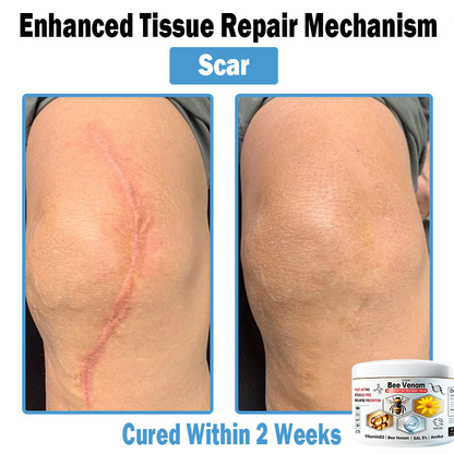 TLOPA® Bee Venom Multi-Symptom Skin Treatment Cream (👨‍⚕BAD RECOMMENDS)💎