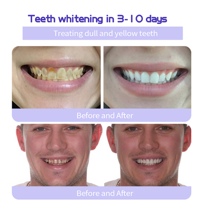 Cvreoz®  (BDA recommended)TeethRestoration Mineral Powder(🦷𝐋𝐢𝐦𝐢𝐭𝐞𝐝 𝐭𝐢𝐦𝐞 𝐝𝐢𝐬𝐜𝐨𝐮𝐧𝐭 𝐋𝐚𝐬𝐭 𝟑𝟎 𝐦𝐢𝐧𝐮𝐭𝐞𝐬🦷)💥