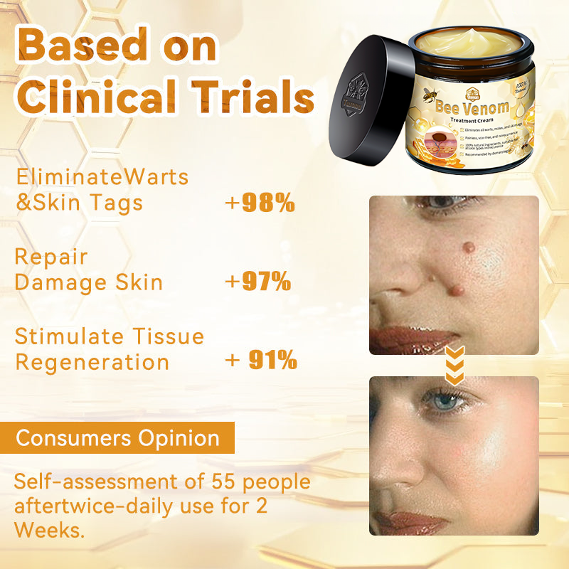 TLOPA® Bee Venom Skin Treatment Cream🌟（𝐵𝐴𝐷  𝑅𝑒𝑐𝑜𝑚𝑚𝑒𝑛𝑑𝑒𝑑）(🔥𝑳𝒂𝒔𝒕 𝒅𝒂𝒚 𝒑𝒓𝒐𝒎𝒐𝒕𝒊𝒐𝒏 70% 𝒐𝒇𝒇)